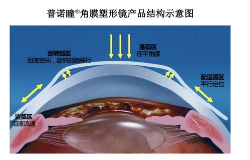 眼科新锐爱博医疗 技术先锋的全球化征程